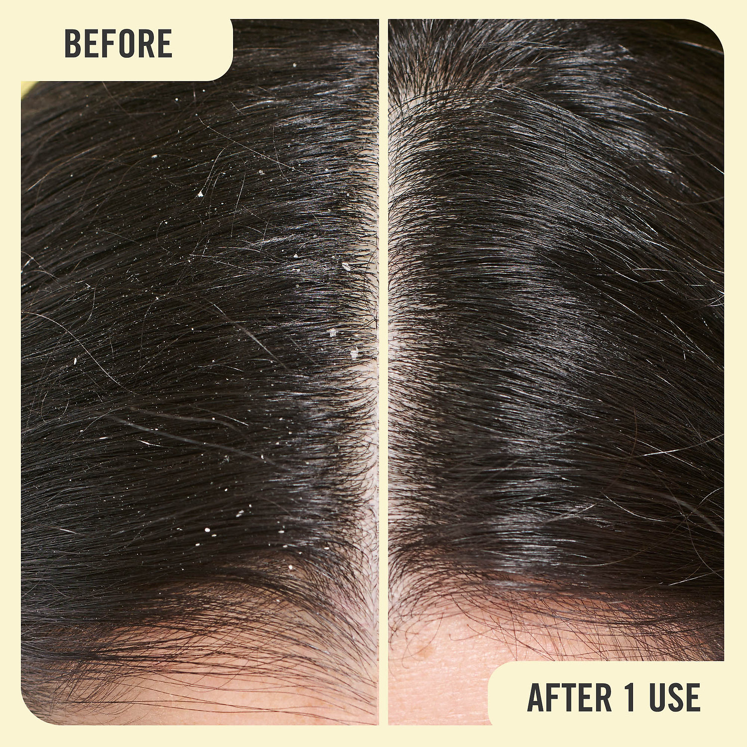 First Aid Beauty AntiDandruff Shampoo with 1 Pyrithione Zinc (ZPT) Mall of America®