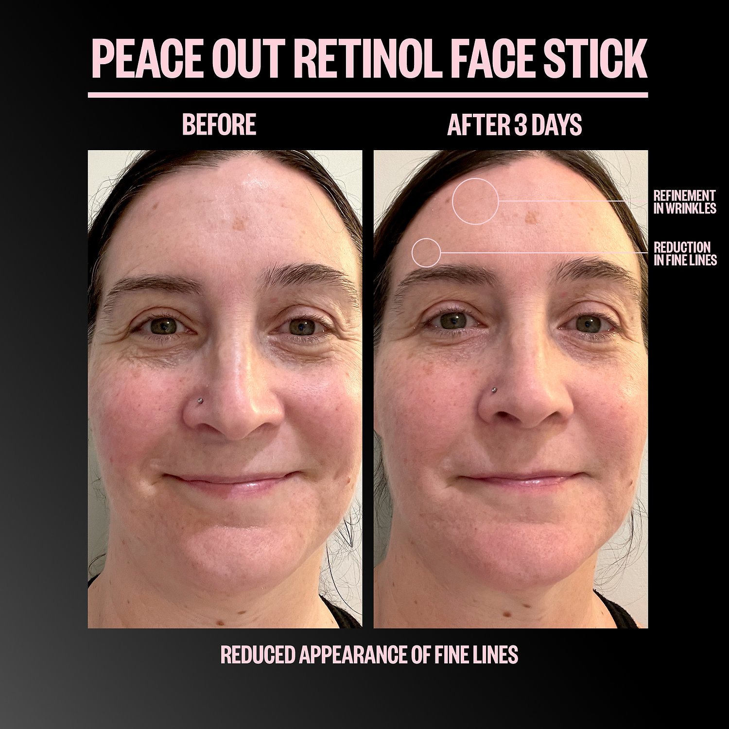 Стик с ретинолом для лица Peace Out Retinol Face Stick — фото 2