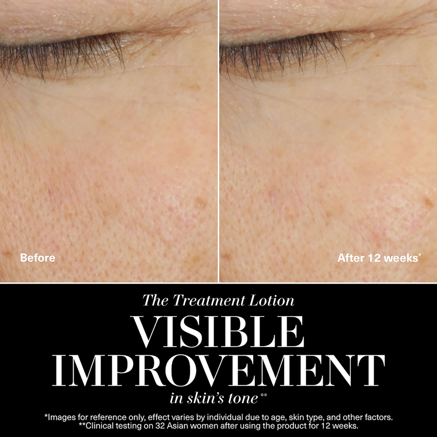 Антивозрастной увлажняющий лосьон-тоник La Mer The Treatment Lotion — фото 2