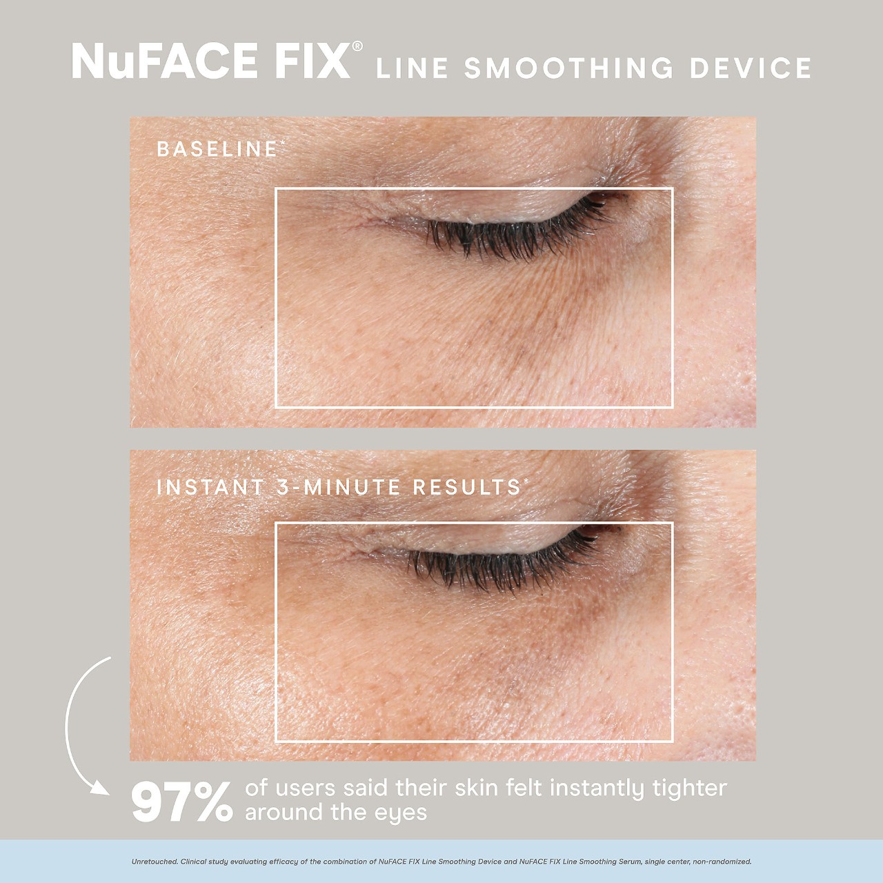 FIX®  Line Smoothing Device