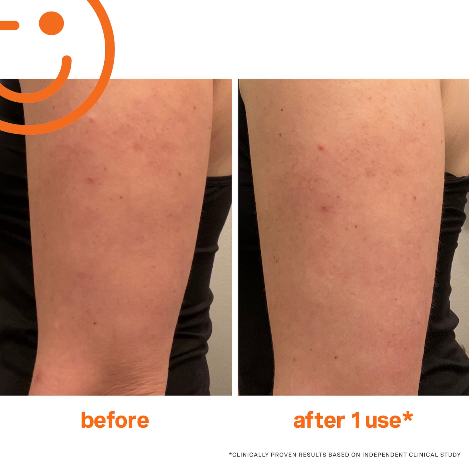 Отшелушивающий скраб для тела Kate Somerville ExfoliKate Resurfacing тройного действия — фото 2