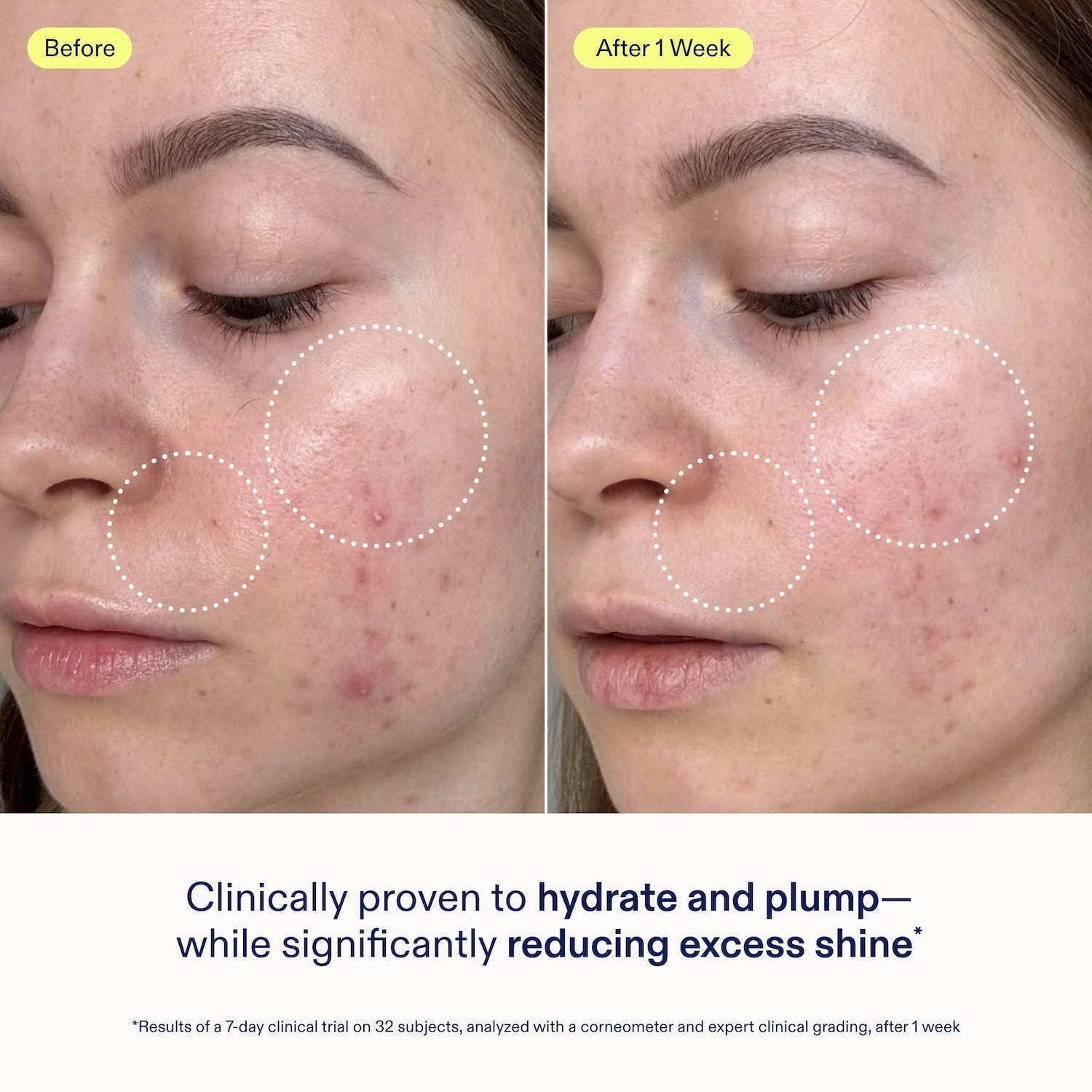 Barrier+ Skin Barrier Niacinamide Restoring Gel Cream - Skinfix