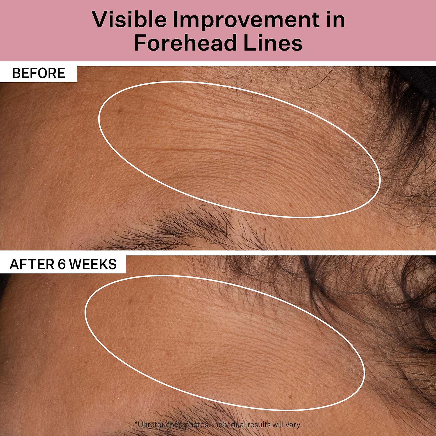 Дневной увлажняющий крем для лица StriVectin Advanced Retinol, SPF 30 — фото 2