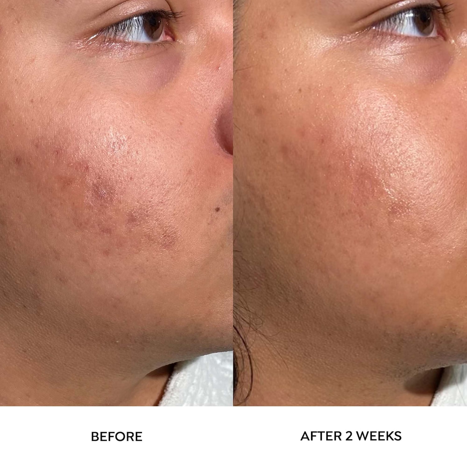 Dr. Zenovia Skincare Scar Gel Treatment Mall of America®