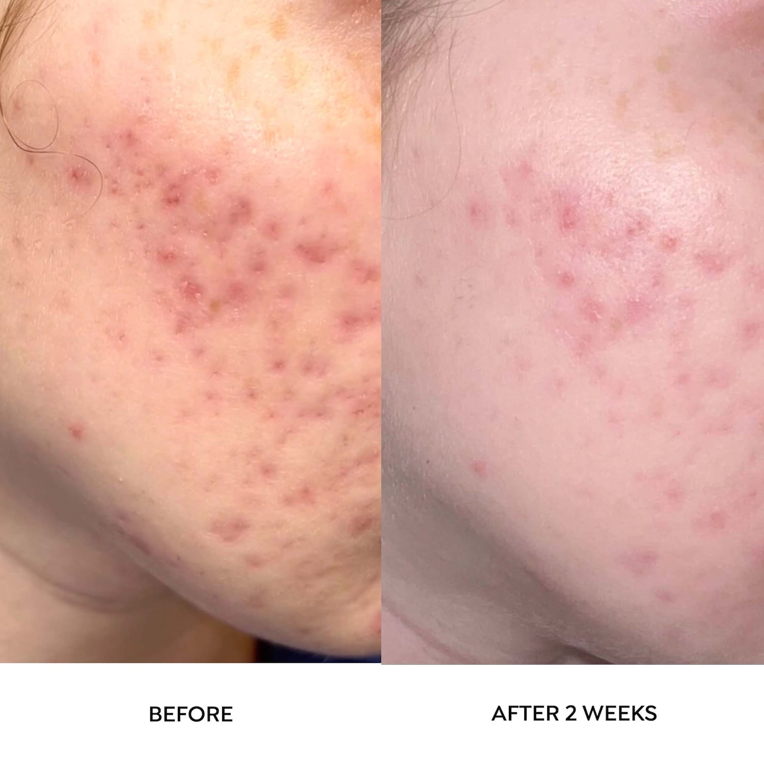 Dr. Zenovia Skincare Scar Gel Treatment The Summit at Fritz Farm