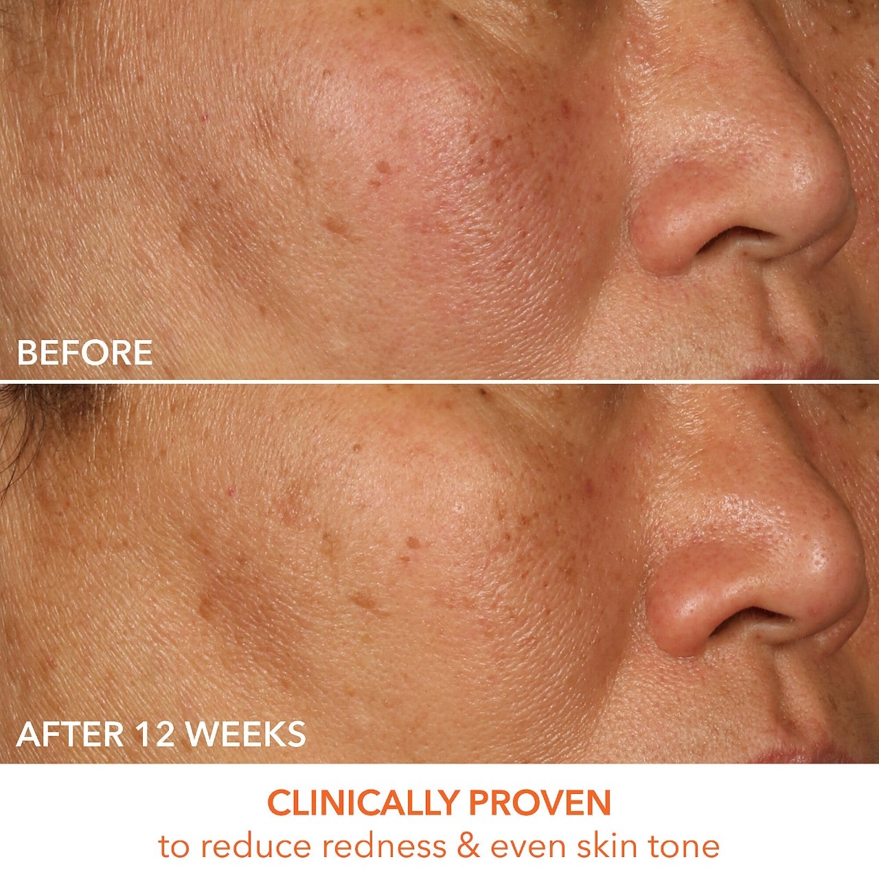 Сыворотка с витамином C и молочной кислотой 15% Dr. Dennis Gross Skincare — фото 2