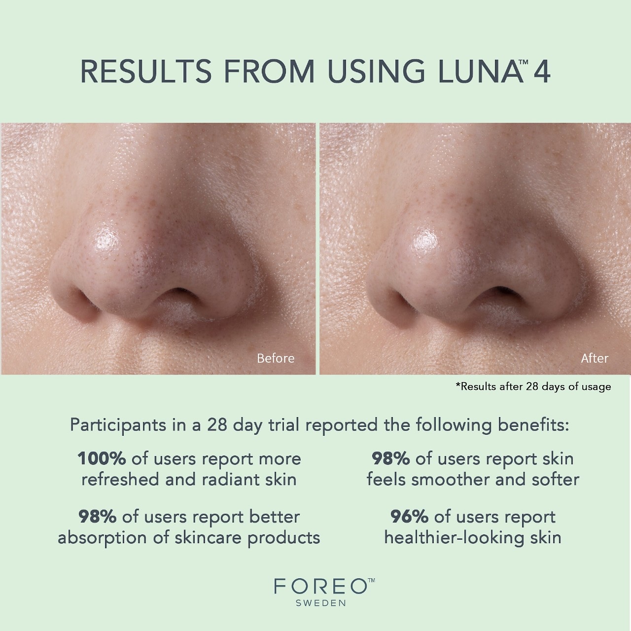 LUNA™ 4 Facial Cleansing & Firming Massage for Combination Skin - FOREO |  Sephora