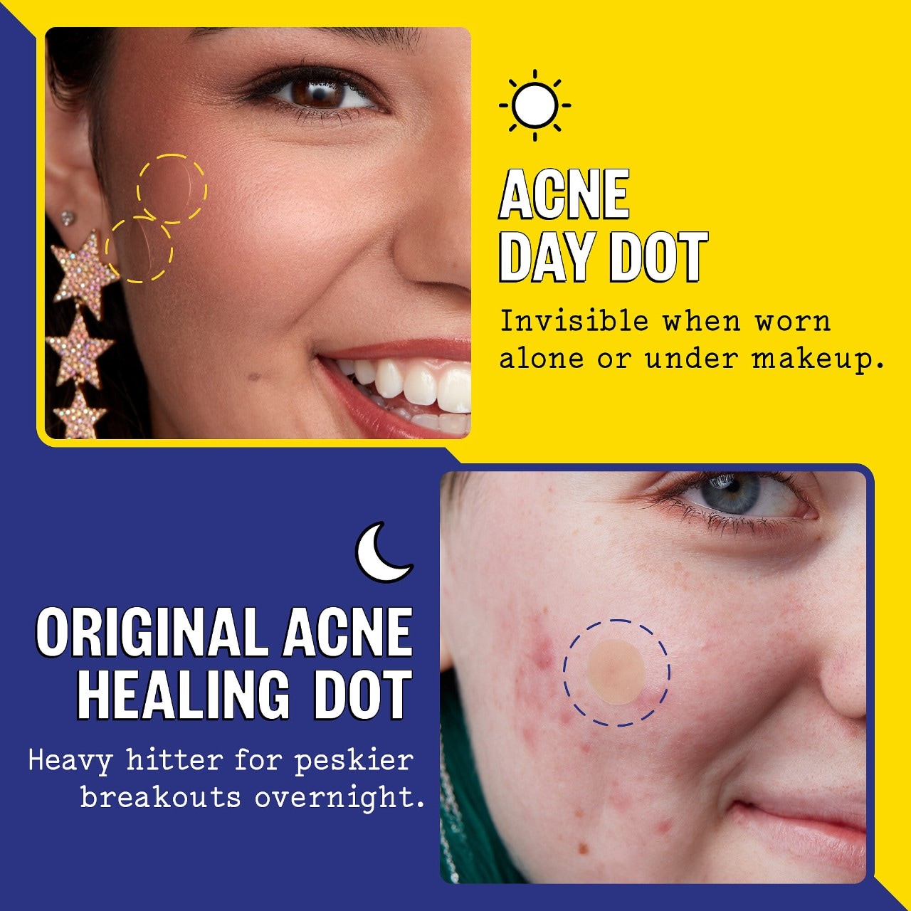 Peace Out Acne Salicylic Acid Day & Night Duo Mall of America®