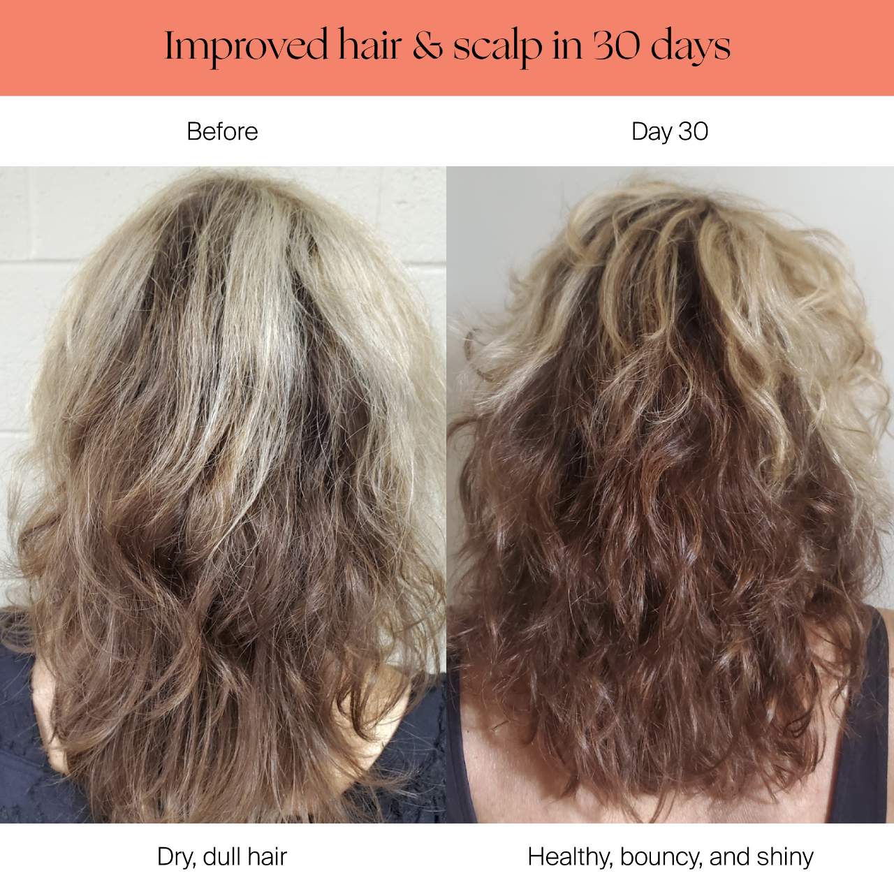 Filtered Showerhead for Healthy Skin & Hair