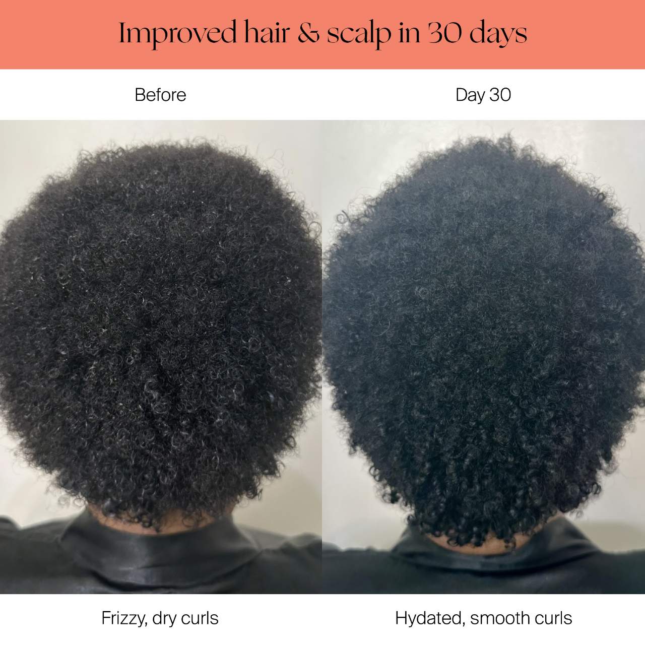 Filtered Showerhead for Healthy Skin & Hair