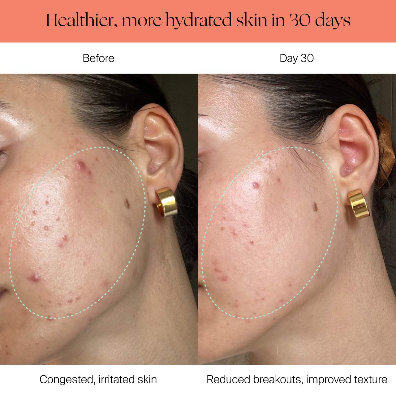 Filtered Showerhead for Healthy Skin & Hair