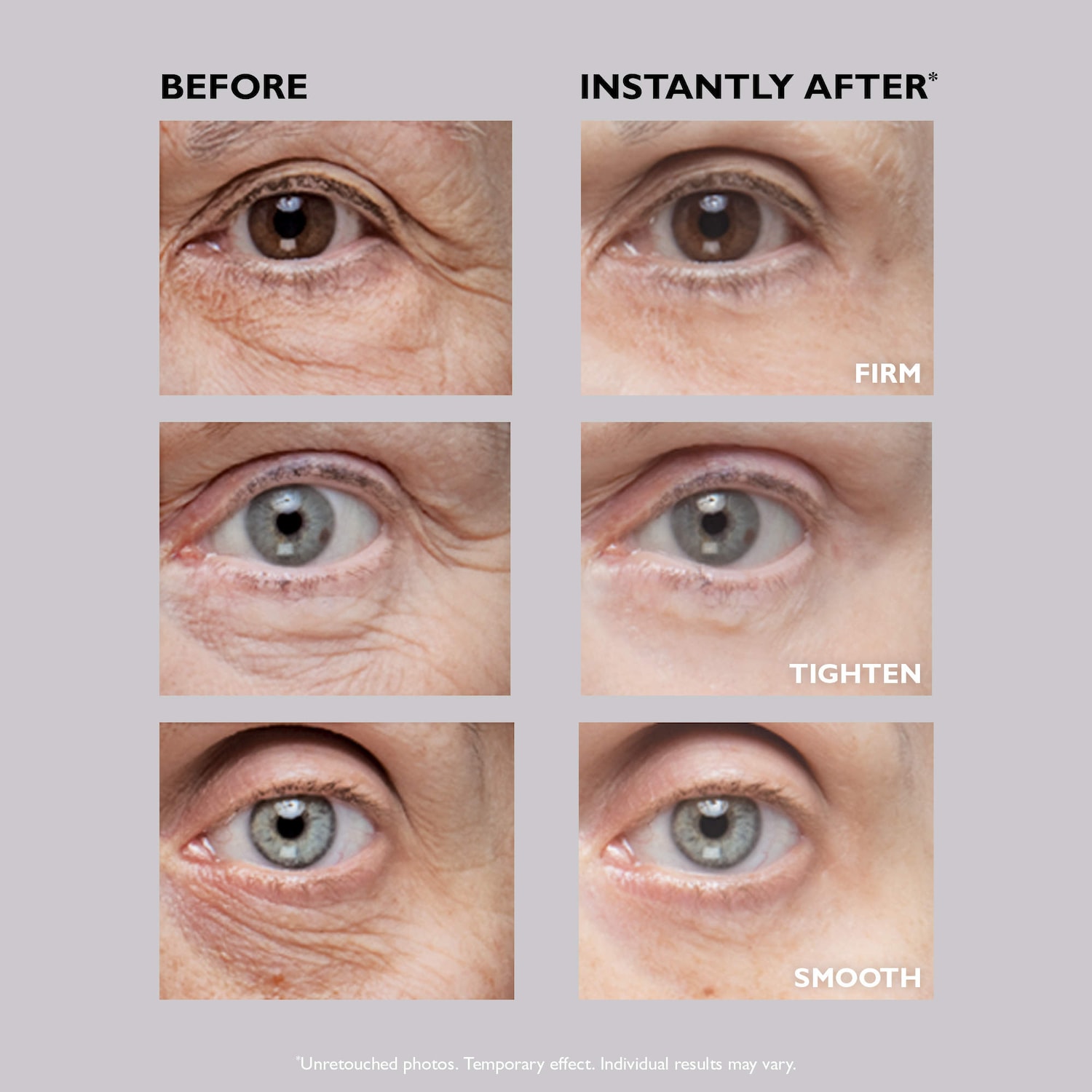 Instant FIRMx® Eye Temporary Eye Tightener - Peter Thomas Roth