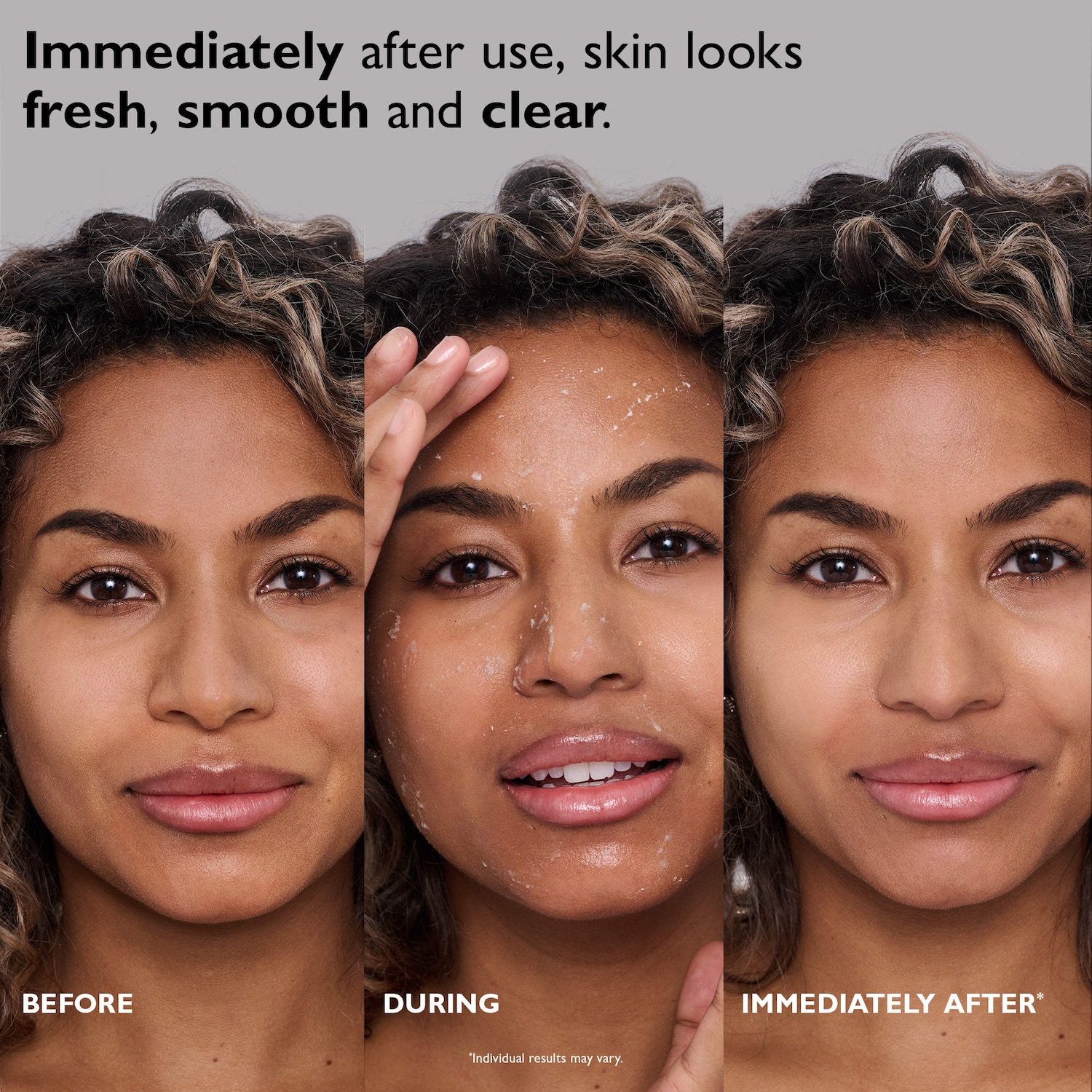 FIRMx® Exfoliating Peeling Gel for Dullness, Pores & Uneven Texture
