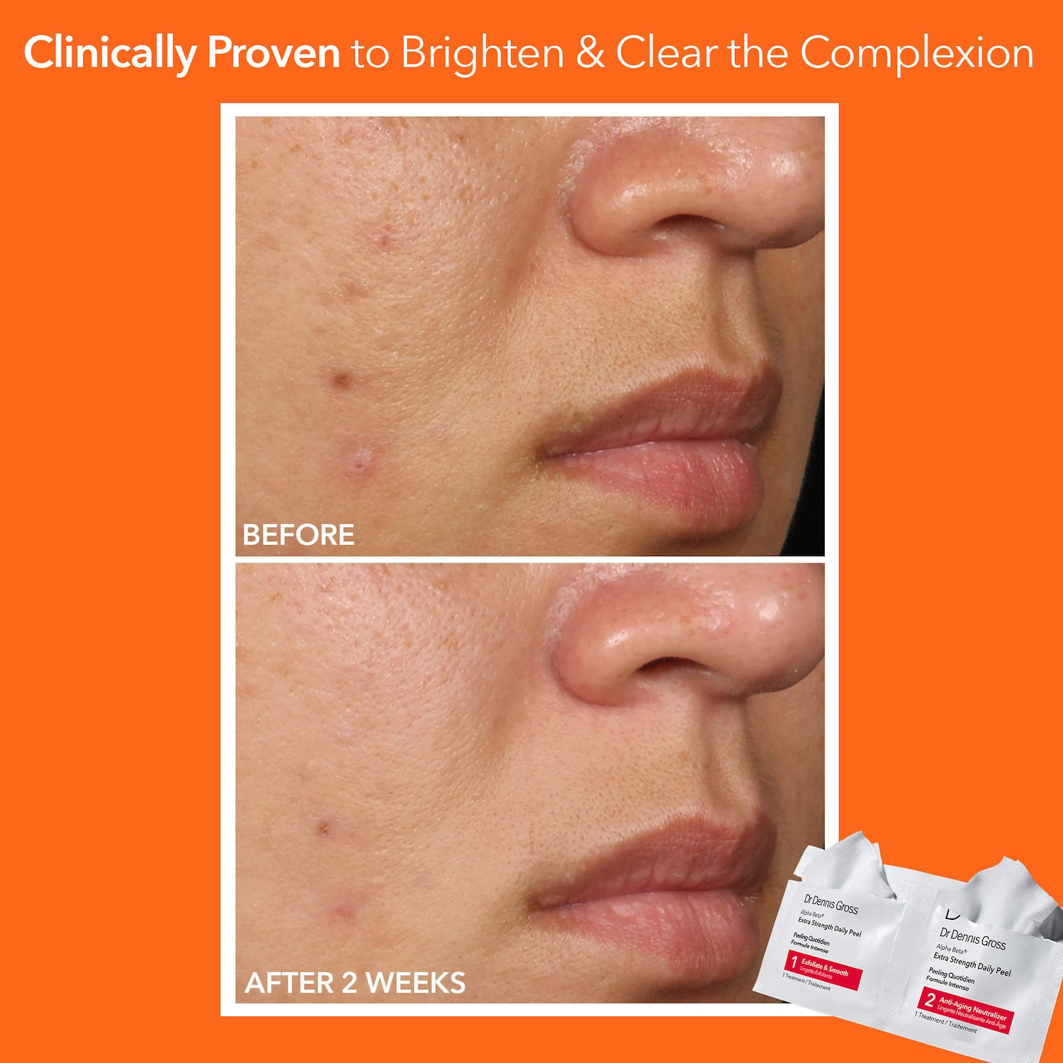 Alpha Beta® Extra Strength Daily Peel Pads