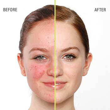 Blemish Clearing Cleanser Juice Beauty Sephora