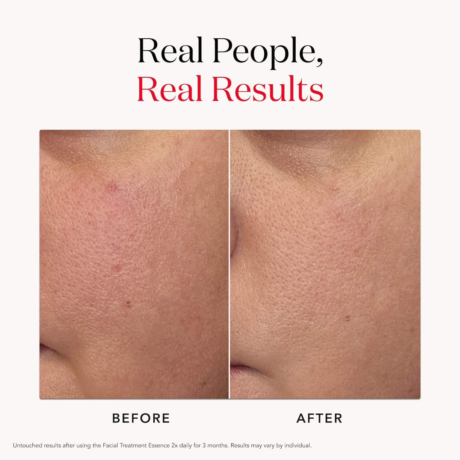 Soin antiâge du visage Essence avec antioxydants