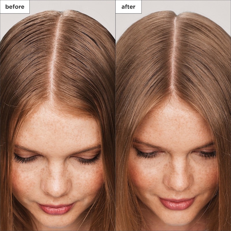 Scalp Revival Charcoal + Tea Tree Scalp Treatment Serum thumbnail 4