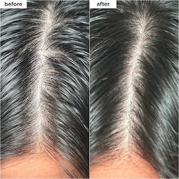 Scalp Revival Charcoal + Biotin Dry Shampoo