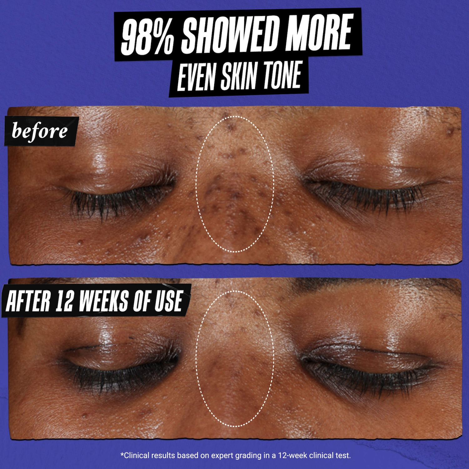 Clearly Corrective™ Dark Spot Correcting Serum with Vitamin C