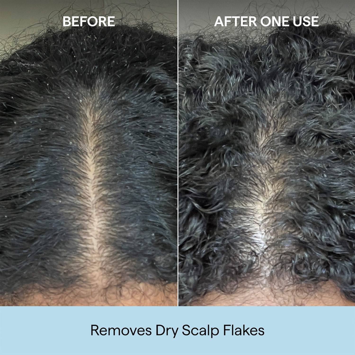 Scalp Revival Charcoal + Coconut Oil Micro-exfoliating Scrub Shampoo