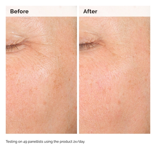 Alpha Arbutin 2% + Hyaluronic Acid for Hyperpigmentation