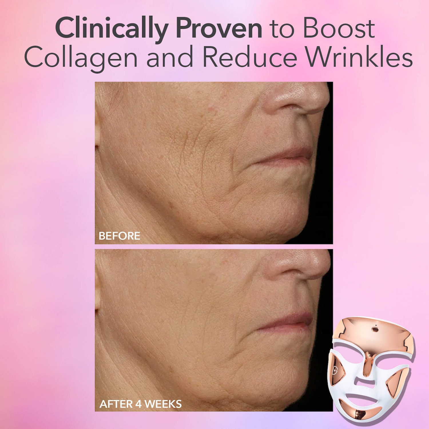 DRx SpectraLite™ FaceWare Pro - Dr. Dennis Gross Skincare