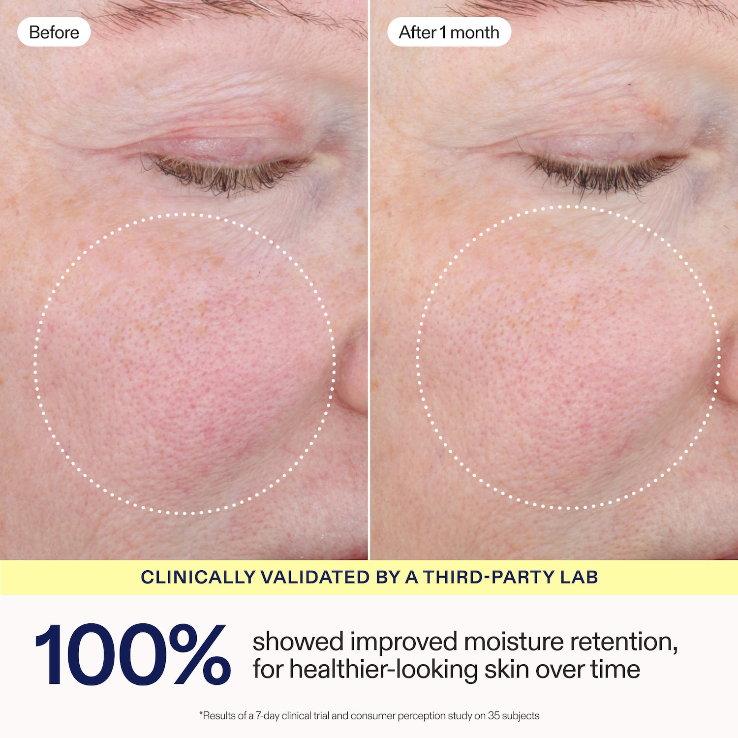 Barrier+ Triple Lipid-Peptide Face Cream - Skinfix | Sephora
