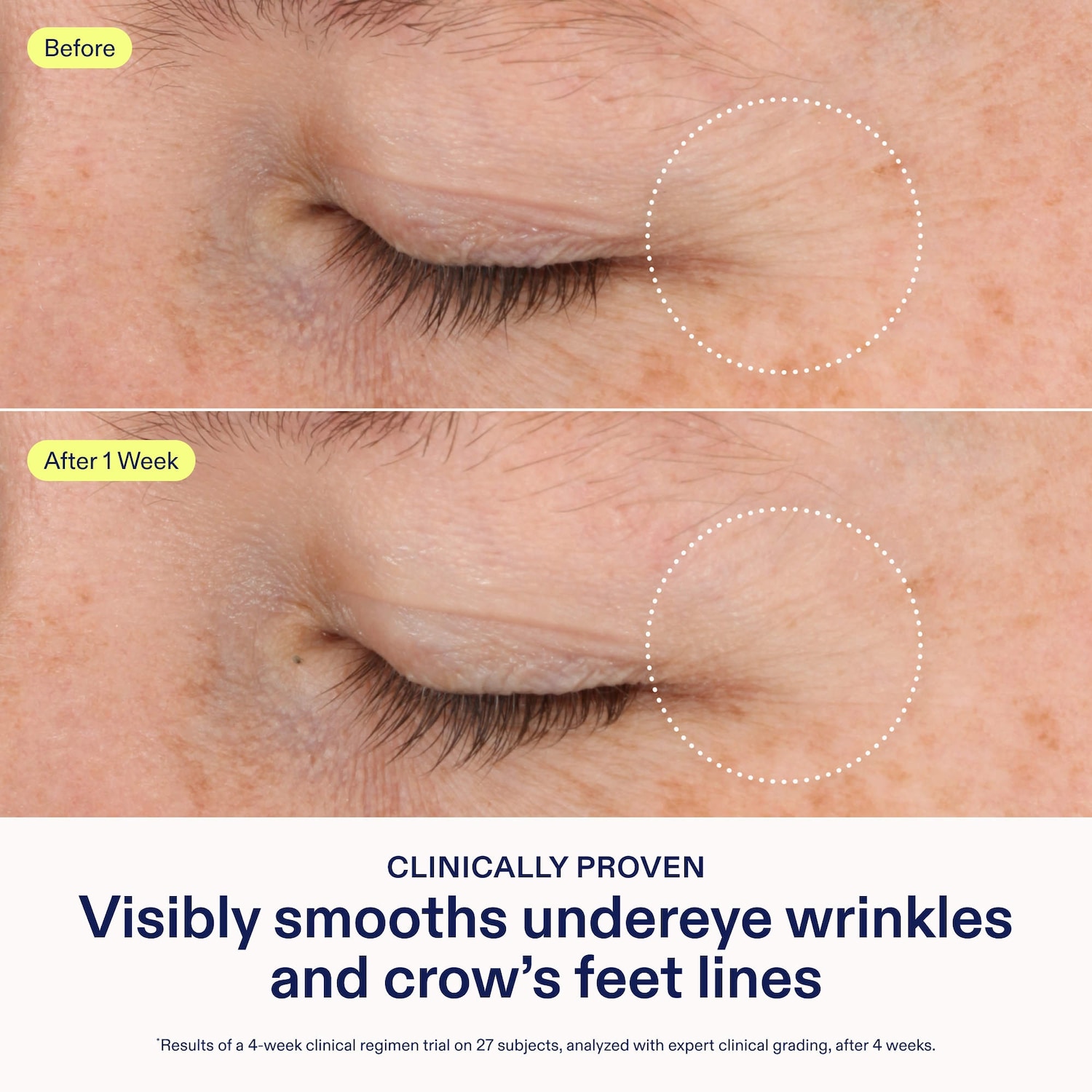 Barrier+ Triple Lipid-Boost 360° Brightening Eye Cream - Skinfix