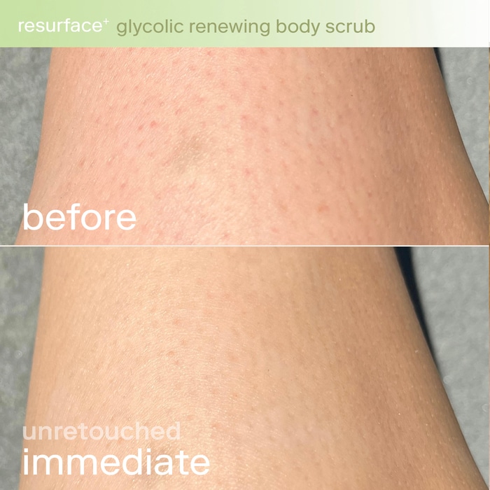 Resurface+ Glycolic and Lactic Acid Renewing Body Scrub thumbnail 4