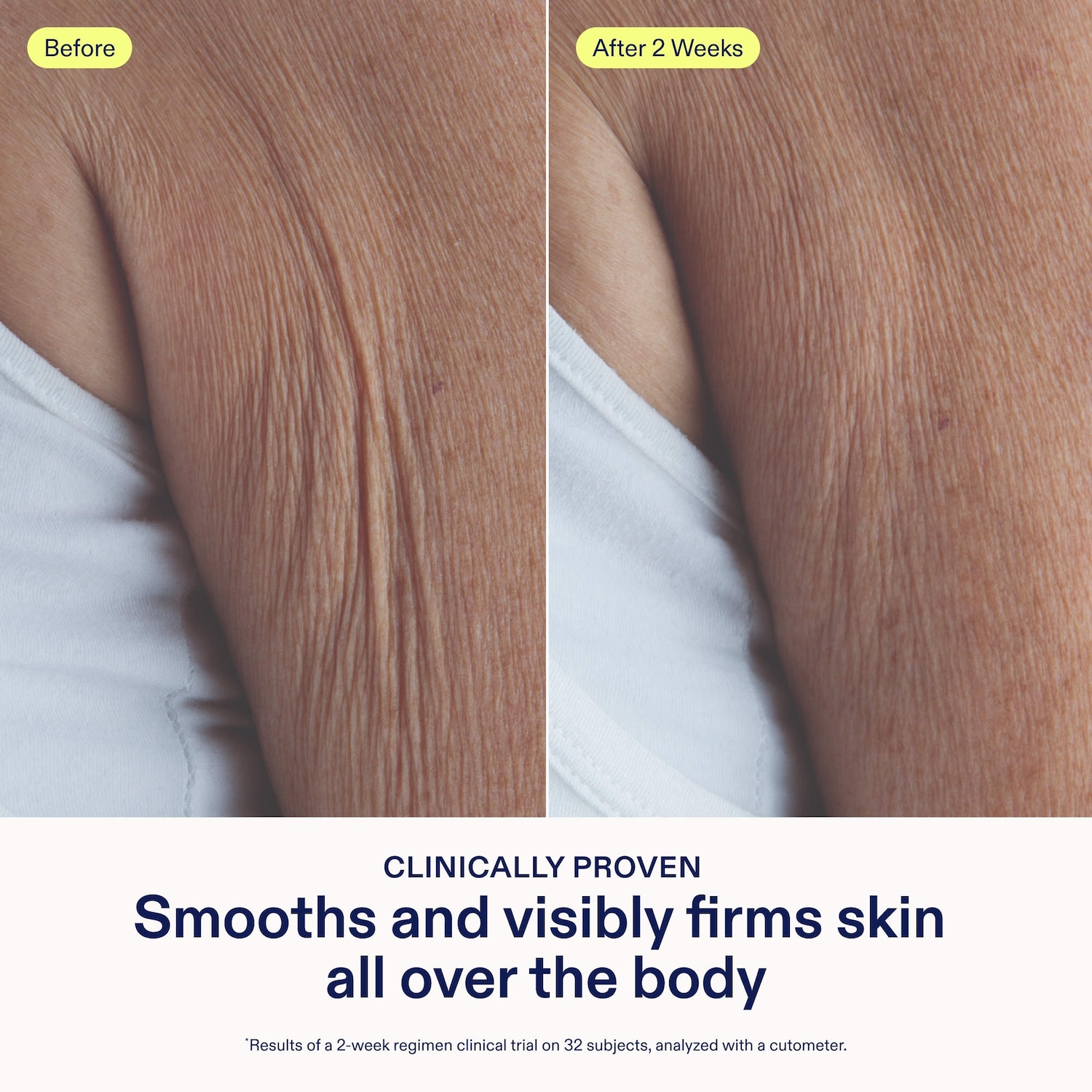 Resurface+ Glycolic and Lactic Acid Renewing Body Scrub - Skinfix