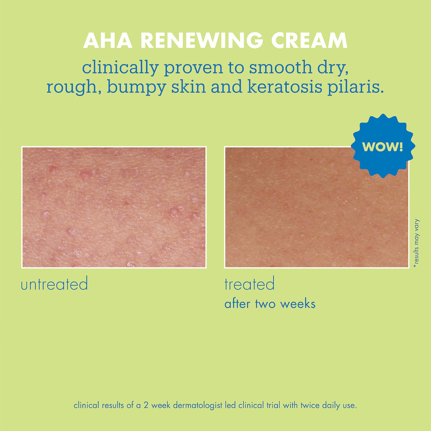 Обновляющий крем для тела с AHA Skinfix Resurface+ — фото 2