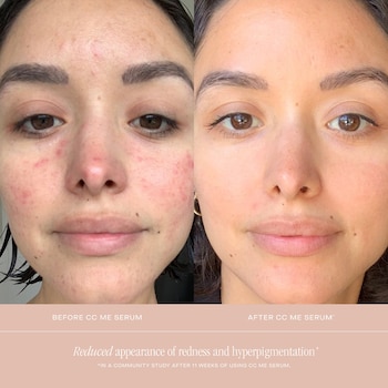 vitamin c serum on lips before and after Farmacy + Peptide Hydrating Lip Balm - Lip Smoothie Moisturizing + Plumping Treatment - Smooths Lines with a High-Gloss Finish youthful look. Freshiny Vitamin C Lip Glow