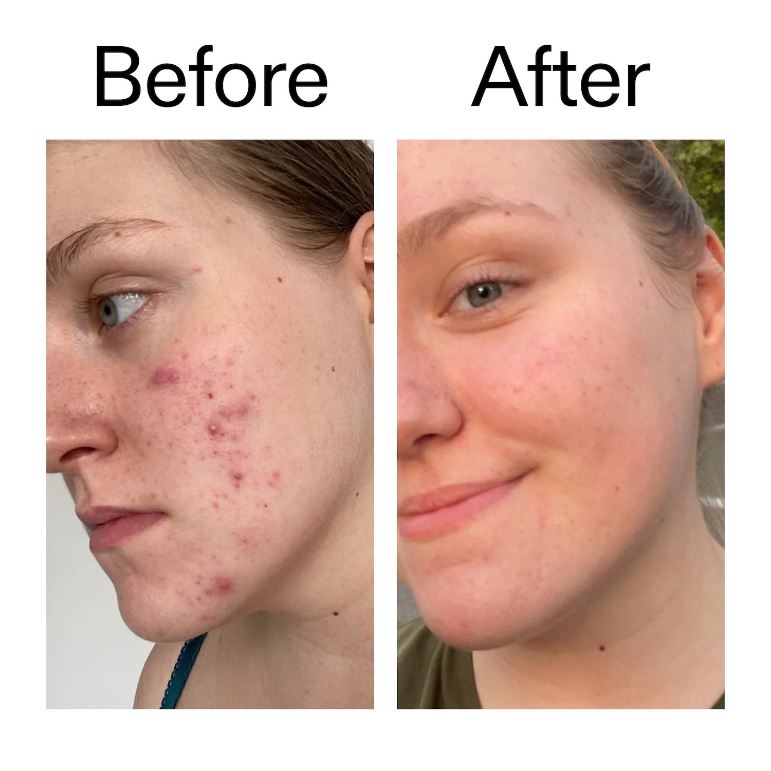 15% Vitamin C & EGF Brightening Serum