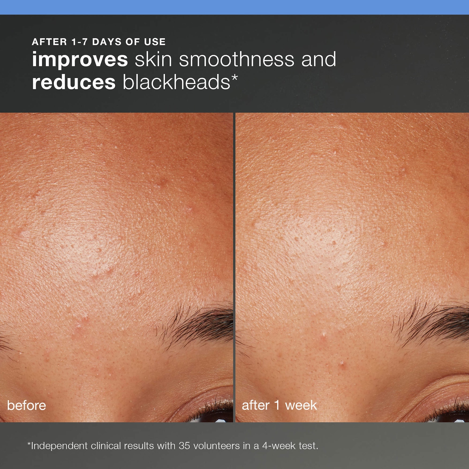 Discover Healthy Skin Kit