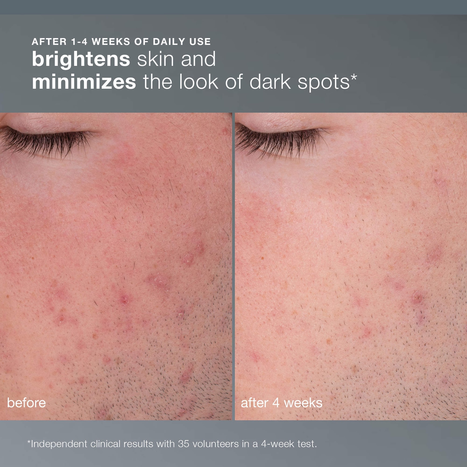 Exfoliant rechargeable Daily Microfoliant