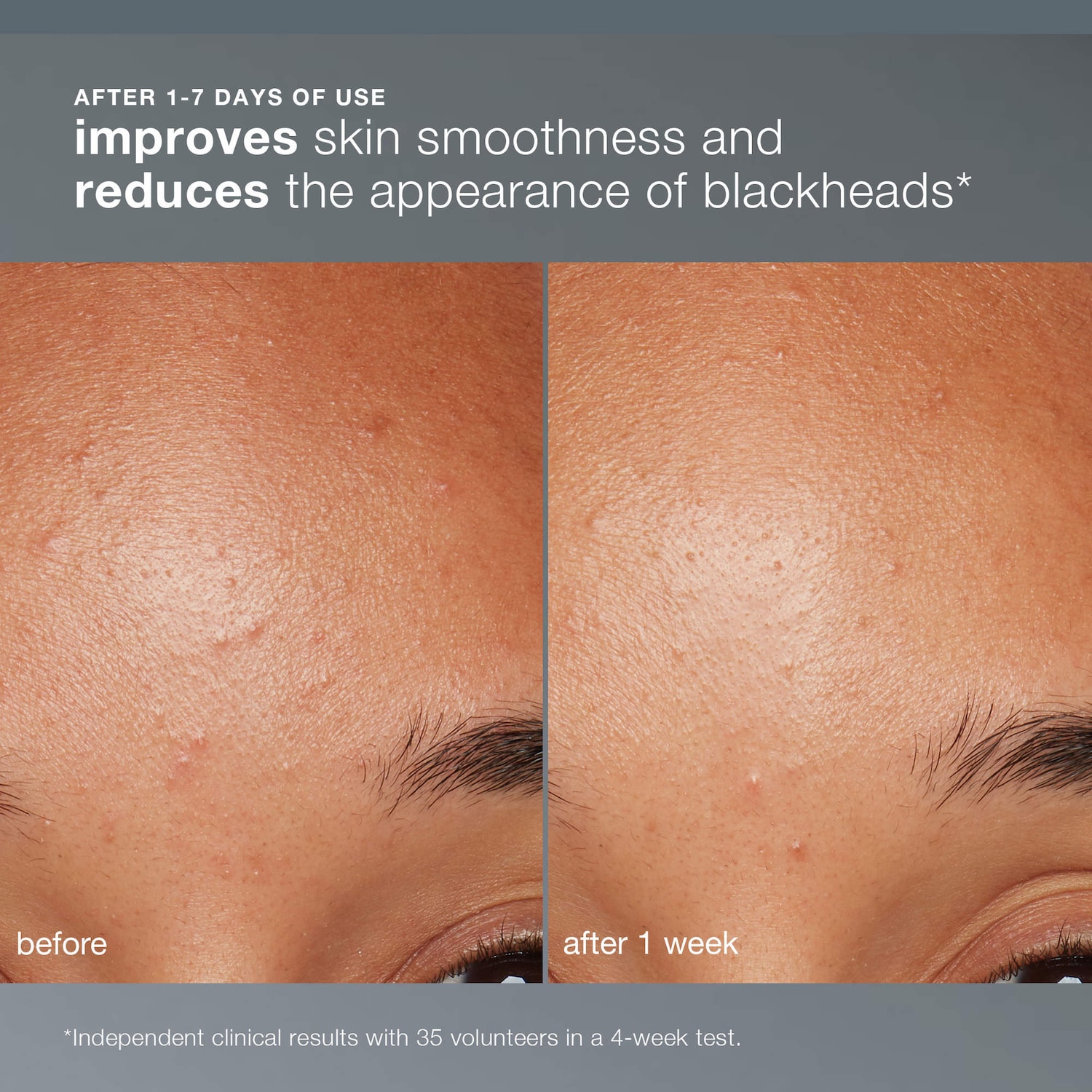 Daily Microfoliant, Salicylic Acid Powder Exfoliator for Pores, Spots & Uneven Skin Tone | Rice Enzyme + BHA Gentle Enough Use