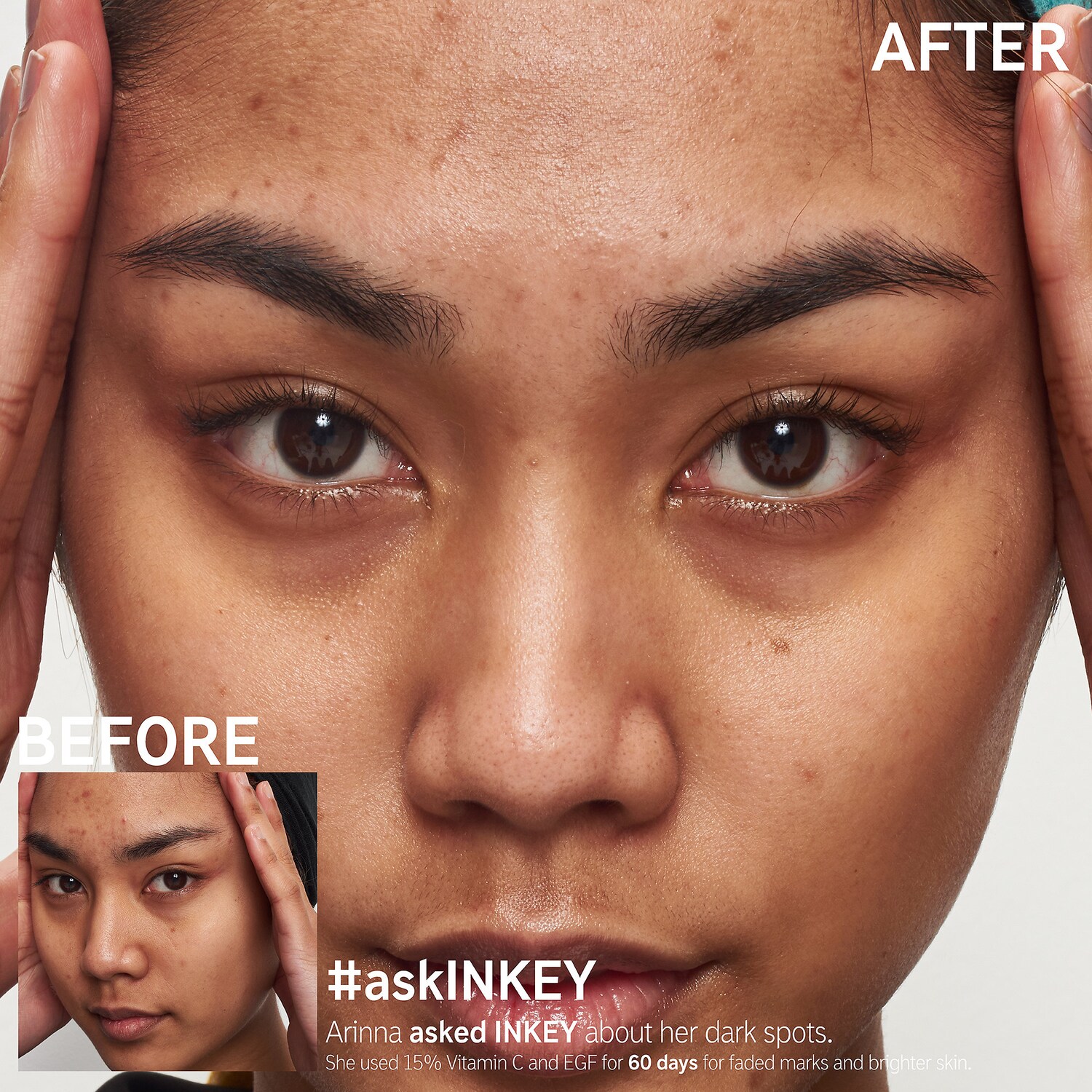 egf serum before after