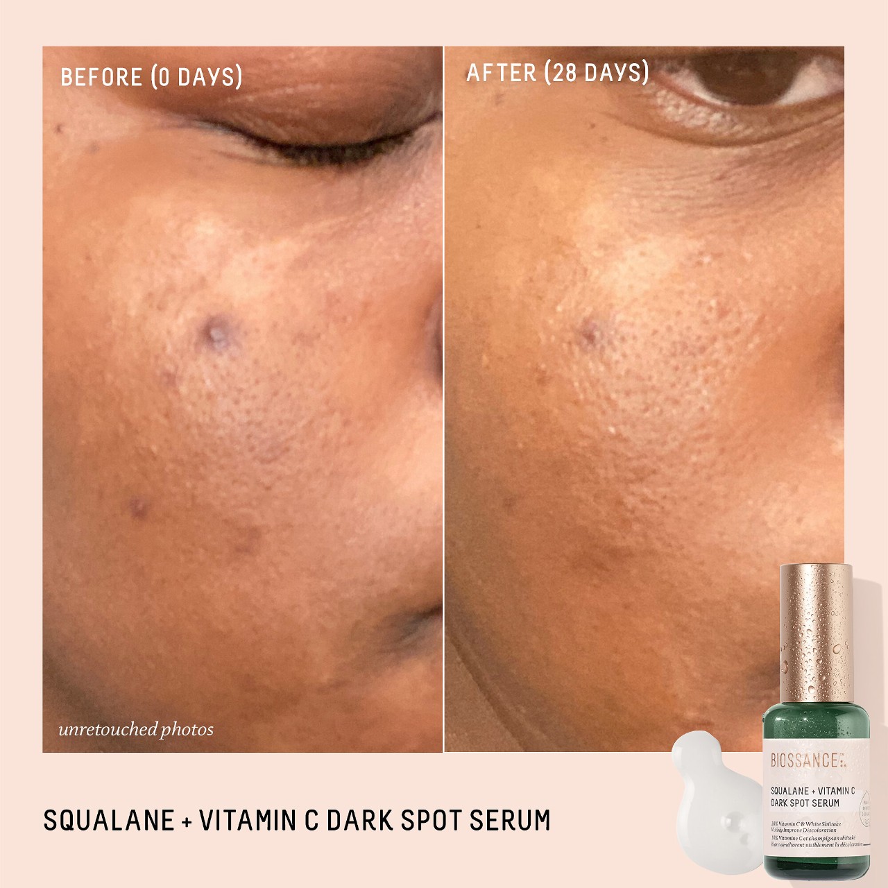 Squalane 10 Vitamin C Dark Spot Serum Biossance Sephora