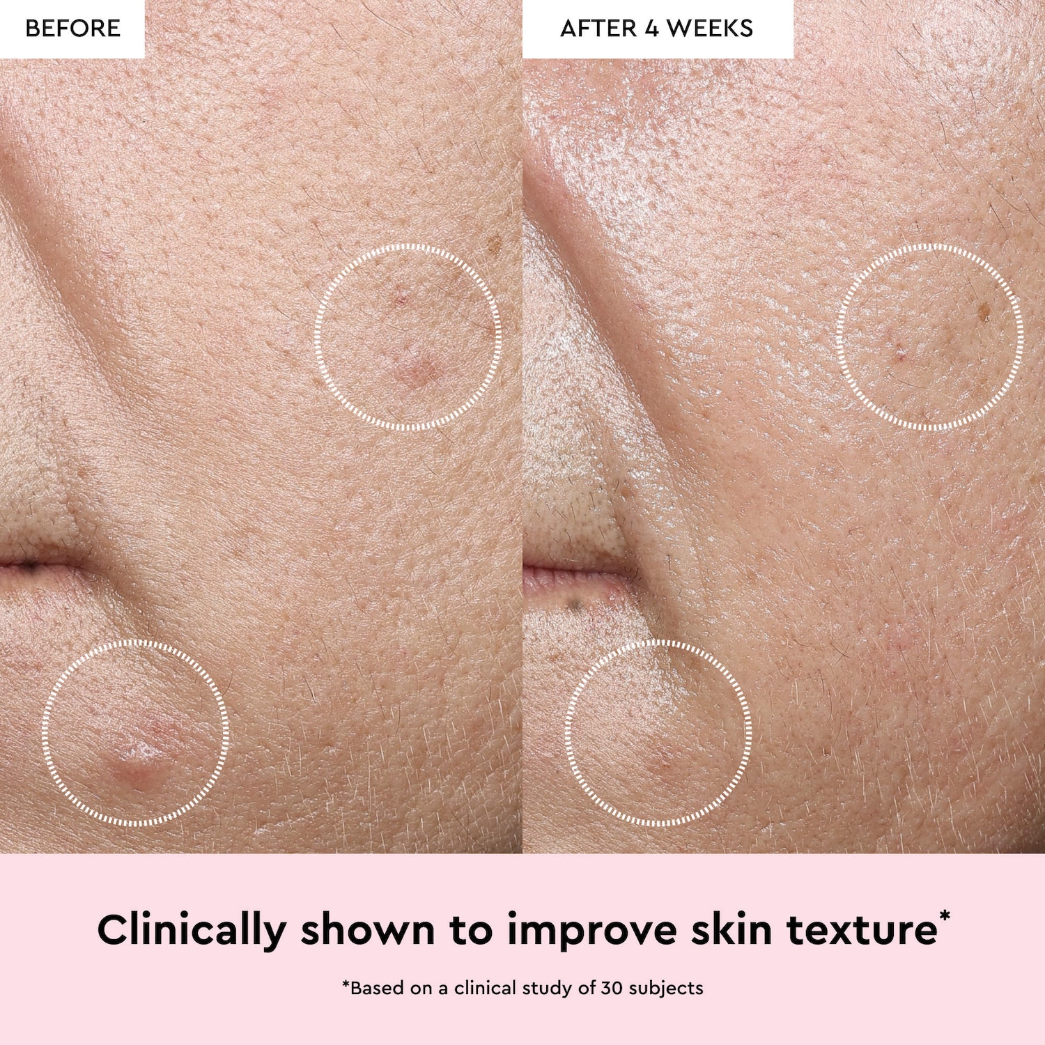 Watermelon Glow Niacinamide Dew Drops Serum