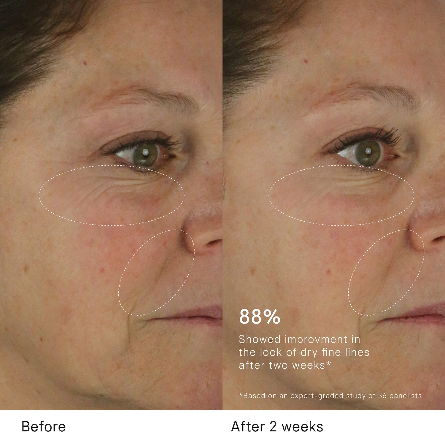 The Dewy Skin Cream Plumping & Hydrating Refillable Moisturizer