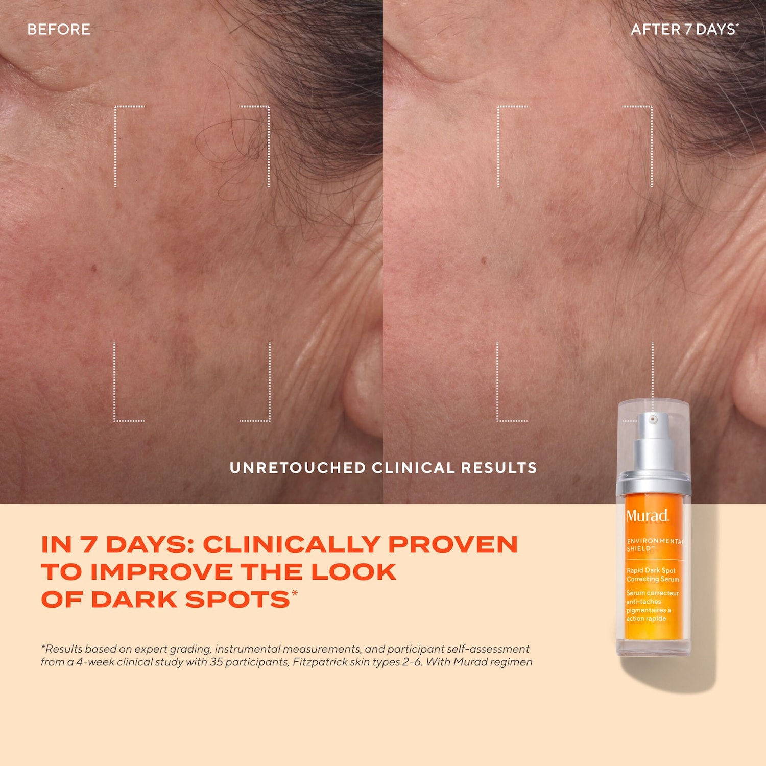 Rapid Dark Spot Correcting Serum with Glycolic and Tranexamic Acid
