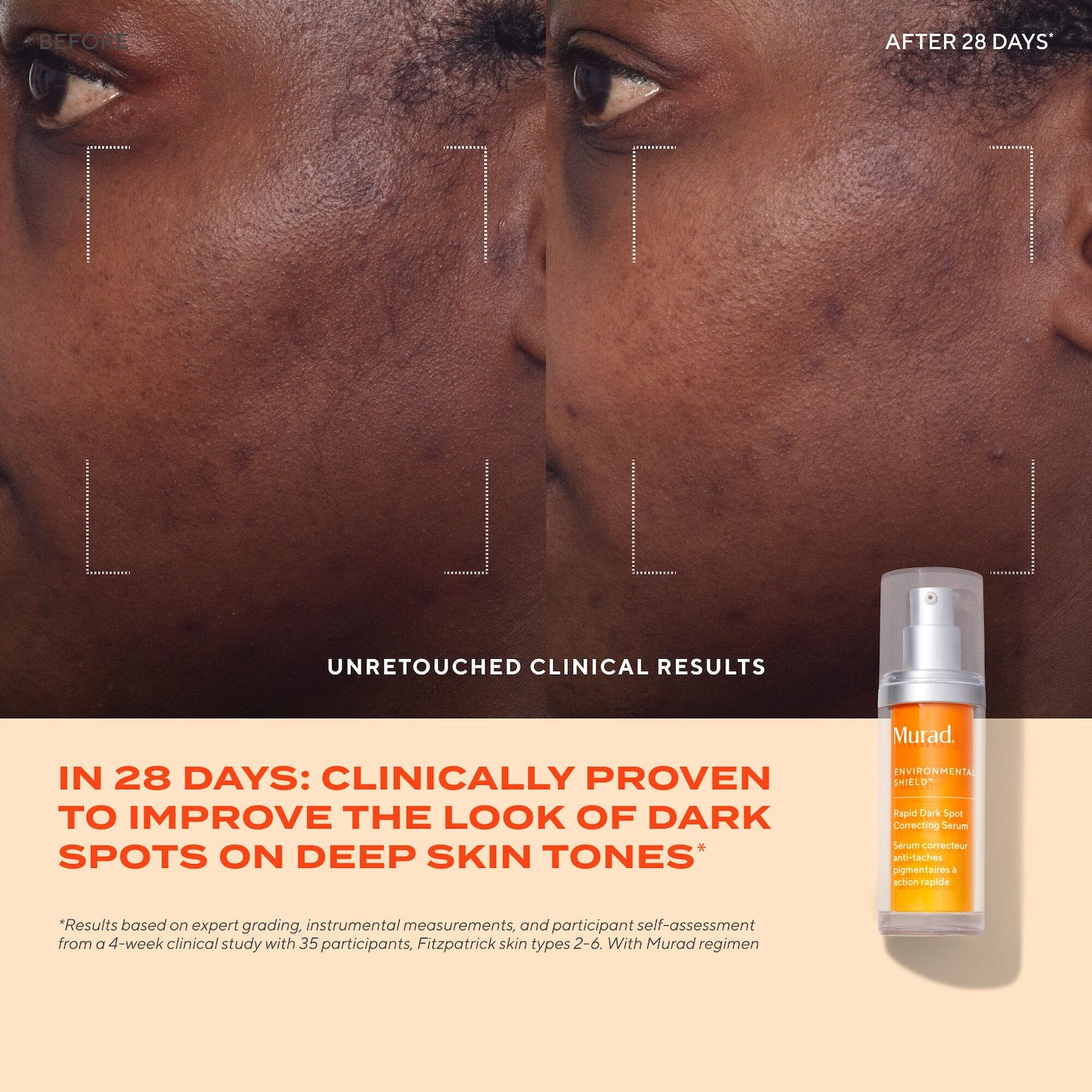 Rapid Dark Spot Correcting Serum with Glycolic and Tranexamic Acid