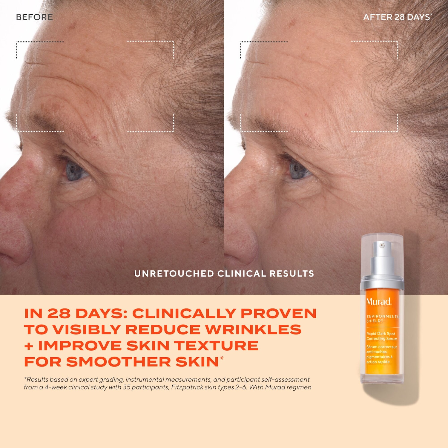 Rapid Dark Spot Correcting Serum with Glycolic and Tranexamic Acid