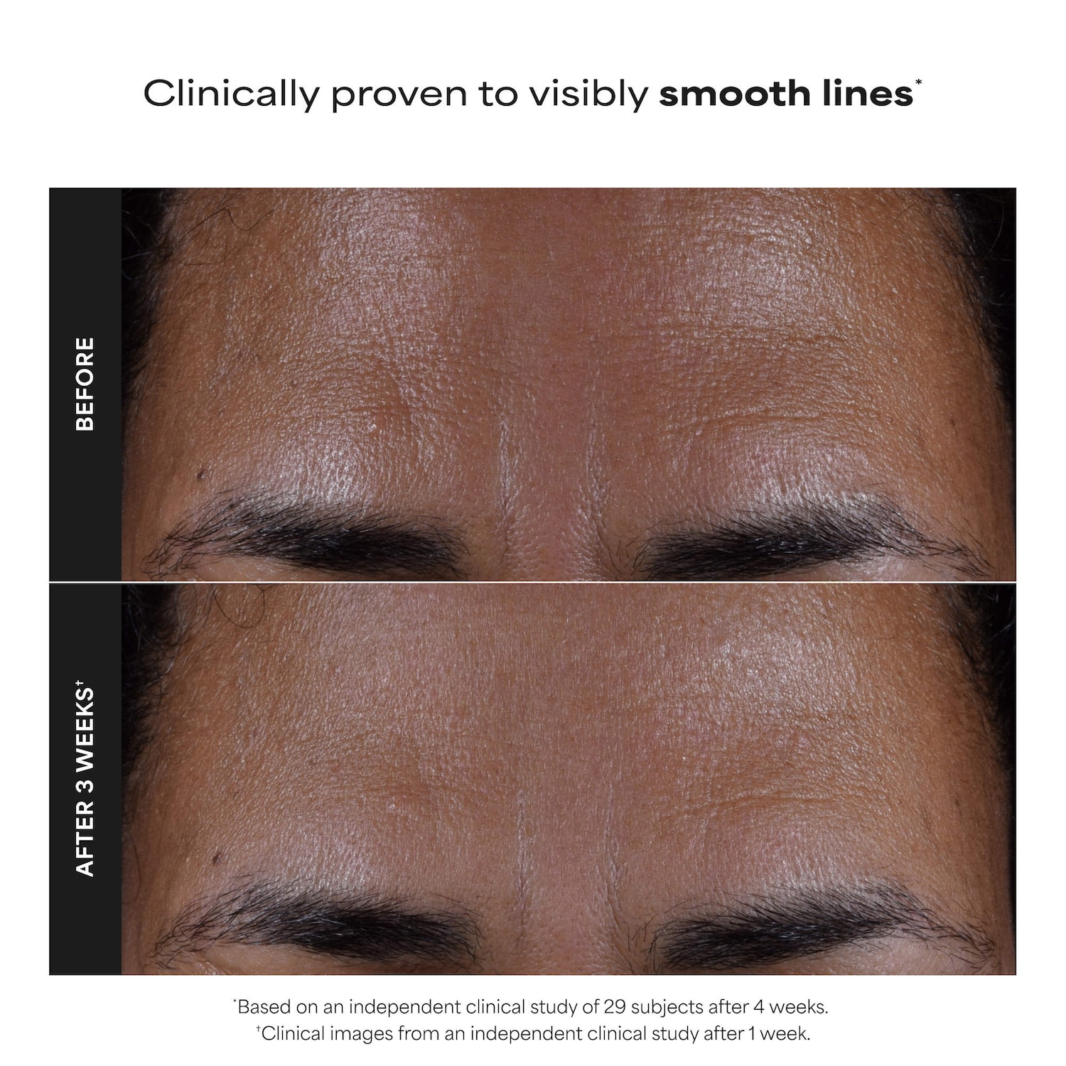 Skin Perfecting 2% BHA Exfoliating Toner for Clear