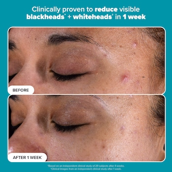 Skin Perfecting 2% BHA Liquid Exfoliant