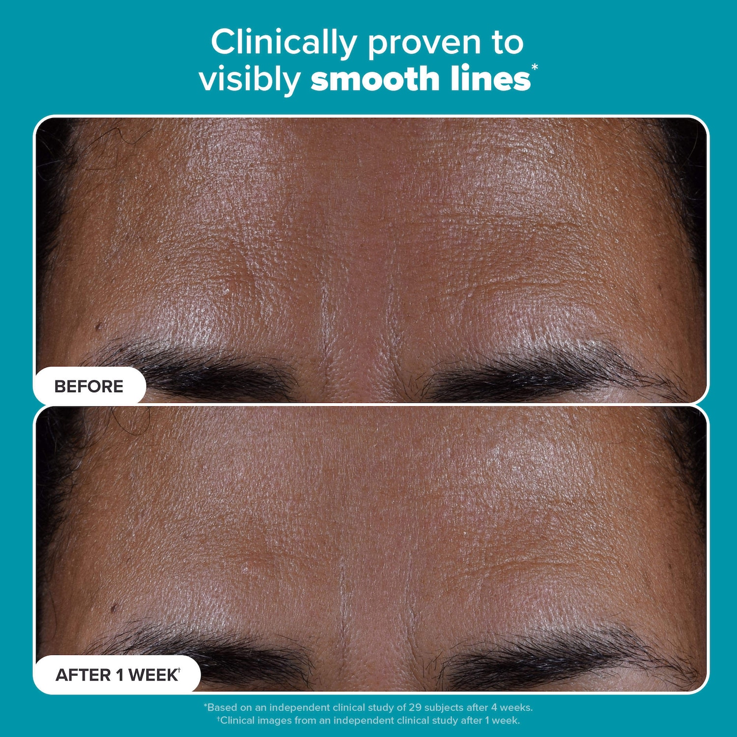Skin Perfecting 2% BHA Exfoliating Toner for Clear