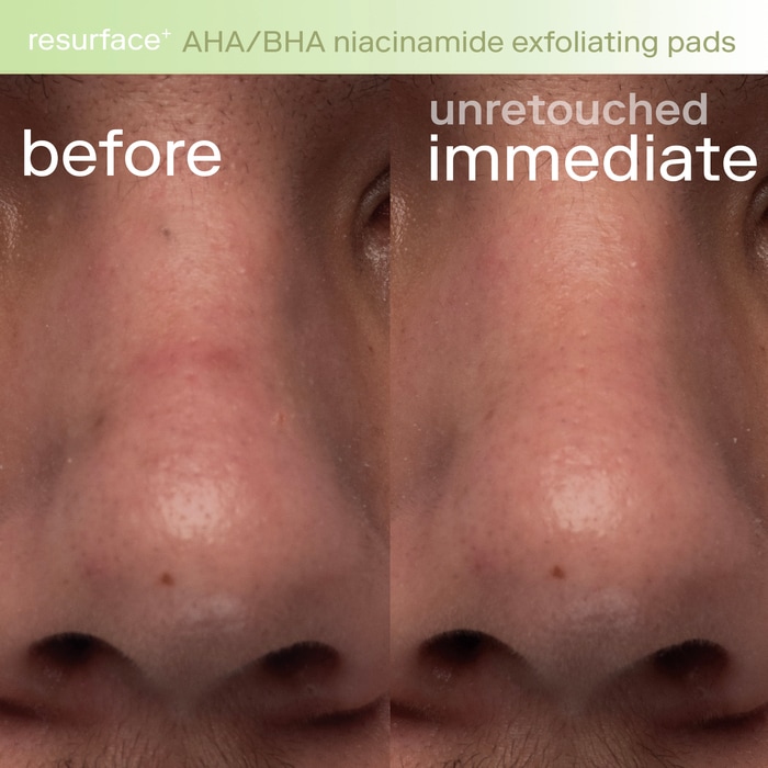 Resurface+ AHA/BHA Niacinamide Exfoliating Pads for Face and Targeted Body thumbnail 3