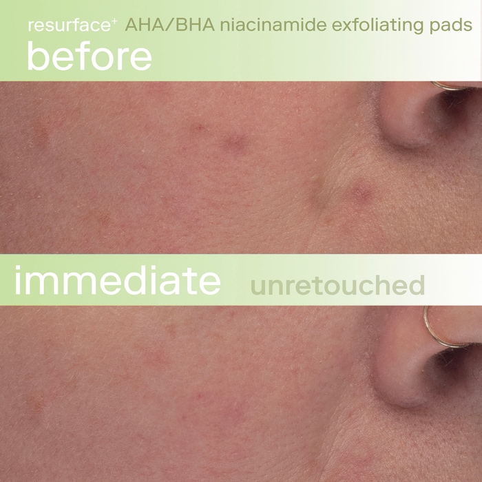 Resurface+ AHA/BHA Niacinamide Exfoliating Pads for Face and Targeted Body thumbnail 4