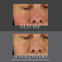 KateCeuticals® Total Repair Cream