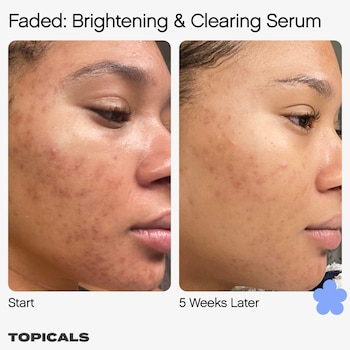Faded Serum For Dark Spots Discoloration Topicals Sephora